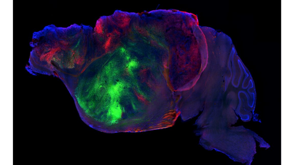 Researchers swap in human brain cells for a mouse’s cortex